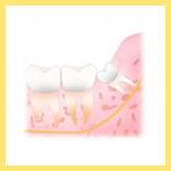 歯科口腔外科治療